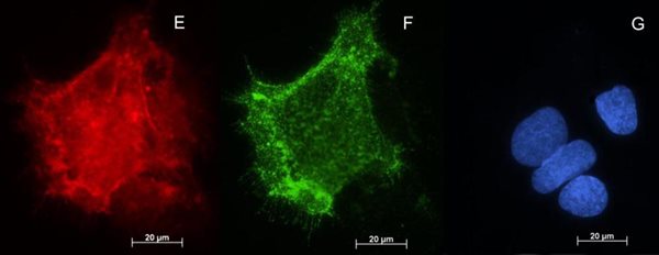Visualisation of BCRP transporter in BeWo choriocarcinoma cells Visualisation of BCRP transporter in BeWo choriocarcinoma cells